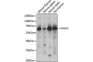 Western blot analysis of extracts of various cell lines, using PUS10 antibody (ABIN7269738) at 1000 dilution. (PUS10 Antikörper  (AA 290-529))