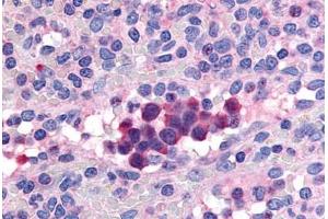 Human Spleen (formalin-fixed, paraffin-embedded) stained with PDE9A antibody ABIN213537 at 20 ug/ml followed by biotinylated goat anti-rabbit IgG secondary antibody ABIN481713, alkaline phosphatase-streptavidin and chromogen. (PDE9A Antikörper  (Internal Region))