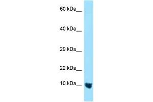 WB Suggested Anti-MTCP1NB Antibody Titration: 1. (CMC4 Antikörper  (N-Term))