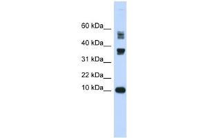 FABP3 antibody used at 1 ug/ml to detect target protein. (FABP3 Antikörper)