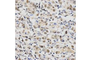 Immunohistochemistry (IHC) image for anti-Small Nuclear Ribonucleoprotein Polypeptide E (SNRPE) antibody (ABIN1876676) (SNRPE Antikörper)