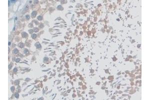 Detection of MYO1D in Rat Testis Tissue using Polyclonal Antibody to Myosin ID (MYO1D) (Myosin ID Antikörper  (AA 512-788))