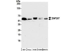 anti-Zinc Finger Protein 207 (ZNF207) (AA 428-478) antibody