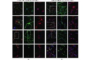 Presence of mature neuronal markers after induction with ICFRYA plus neurotrophic factors and FBS in UCB- and BM-MSCs.