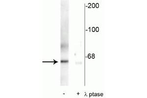 Western blot of rat synaptic membrane showing specific immunolabeling of the ~66 kDa PLK protein phosphorylated at Thr210 in the first lane (-). (PLK1 Antikörper  (pThr210))