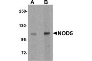 Western blot analysis of NOD5 in rat spleen tissue cell lysate with NOD5 antibody at (A) 1 and (B) 2 μg/ml.