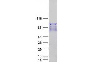 Validation with Western Blot (Plakophilin 3 Protein (PKP3) (Myc-DYKDDDDK Tag))