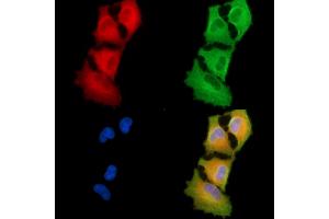 ABIN6264816 and ABIN6279786 staining  cells by IF/ICC. (RPAP3 Antikörper  (N-Term))