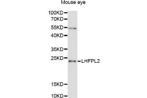 Western blot analysis of extracts of mouse eye, using LHFPL2 antibody (ABIN6294117) at 1:3000 dilution. (LHFPL2 Antikörper)