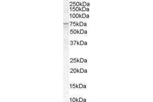 Western Blotting (WB) image for Acyl-CoA Synthetase Long-Chain Family Member 5 (ACSL5) peptide (ABIN369836) (Acyl-CoA Synthetase Long-Chain Family Member 5 (ACSL5) Peptid)