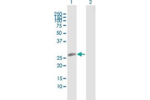 Western Blotting (WB) image for anti-Major Histocompatibility Complex, Class II, DR beta 5 (HLA-DRB5) (AA 1-266) antibody (ABIN516520)
