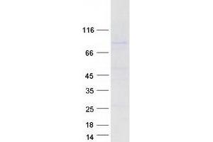 Validation with Western Blot