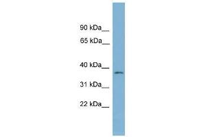 Western Blot showing NUBP1 antibody used at a concentration of 1-2 ug/ml to detect its target protein. (NUBP1 Antikörper  (Middle Region))