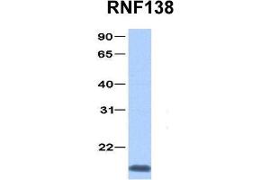 Host:  Rabbit  Target Name:  RNF138  Sample Type:  Jurkat  Antibody Dilution:  1. (RNF138 Antikörper  (C-Term))
