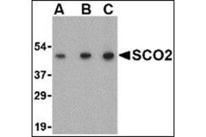 Western blot analysis of SCO2 in human liver tissue lysate with this product at (A) 0. (SCO2 Antikörper  (C-Term))