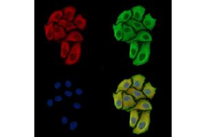 ABIN7097182 and ABIN7101250 staining Hela cells by IF/ICC. (FAM122B Antikörper)