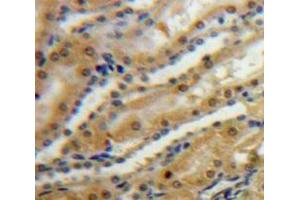 IHC-P analysis of Kidney tissue, with DAB staining. (SPARC Antikörper  (AA 18-303))