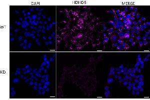 Immunocytochemical staining of HeLa cells using HDHD5 antibody (ABIN7798836), 1:1,000), Top panel: wild-type (WT), Bottom panal: HDHD5 shRNA knockdown (KD). (Rekombinanter Haloacid Dehalogenase-Like Hydrolase Domain-Containing 5 (HDHD5) Antikörper)