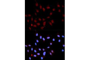 Immunofluorescence analysis of U2OS cell using Phospho-Stat3-Y705 antibody. (STAT3 Antikörper  (pTyr705))