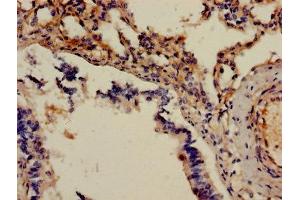Immunohistochemistry of paraffin-embedded human lung tissue using ABIN7143430 at dilution of 1:100 (Adrenomedullin Antikörper  (AA 45-92))