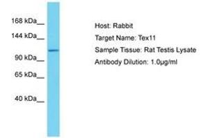 Image no. 1 for anti-Testis Expressed 11 (TEX11) (AA 39-88) antibody (ABIN6750355) (TEX11 Antikörper  (AA 39-88))