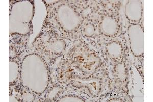 Immunoperoxidase of monoclonal antibody to RCC1 on formalin-fixed paraffin-embedded human thyroid nodular goiter. (RCC1 Antikörper  (AA 312-421))