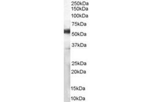 Image no. 2 for anti-CD14 (CD14) (Internal Region) antibody (ABIN374645) (CD14 Antikörper  (Internal Region))