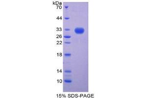 SDS-PAGE (SDS) image for Centromere Protein H (CENPH) (AA 1-247) protein (His tag) (ABIN2124295)