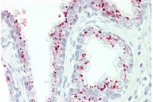 Human Prostate: Formalin-Fixed, Paraffin-Embedded (FFPE) (GAA Antikörper  (AA 174-203))