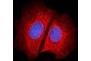 Immunofluorescence (IF) image for anti-Keratin 1 (KRT1) antibody (Alexa Fluor 647) (ABIN2657196) (Cytokeratin 1 Antikörper  (Alexa Fluor 647))