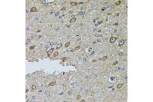 Immunohistochemistry of paraffin-embedded rat brain using MTIF3 antibody.