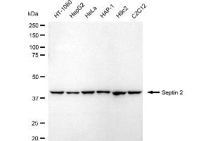 Western blotting analysis using Septin 2 antibody (ABIN7800295). (Rekombinanter Septin 2 Antikörper)