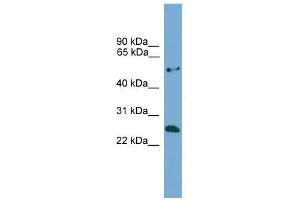 Western Blot showing ETHE1 antibody used at a concentration of 1-2 ug/ml to detect its target protein. (ETHE1 Antikörper  (Middle Region))
