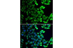 Immunofluorescence analysis of U20S cell using UIMC1 antibody. (UIMC1 Antikörper)