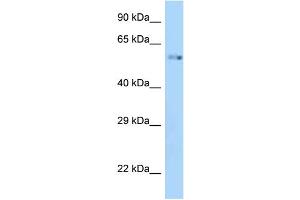 WB Suggested Anti-Zik1 Antibody Titration: 1. (ZIK1 Antikörper  (C-Term))