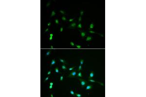 Immunofluorescence analysis of A549 cells using PIWIL4 antibody (ABIN5971612). (PIWIL4 Antikörper)