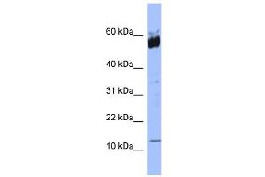 WB Suggested Anti-S100A9 Antibody Titration: 0. (S100A9 Antikörper  (N-Term))