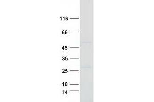 Western Blotting (WB) image for Septin 7 (SEPT7) (Transcript Variant 1) protein (Myc-DYKDDDDK Tag) (ABIN2731694)