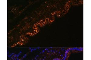 Immunofluorescence analysis of Rat lung cells using SCNN1A Polyclonal Antibody at dilution of 1:100. (SCNN1A Antikörper)