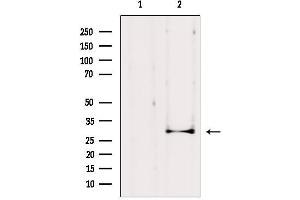 Western blot analysis of extracts from HepG2, using AQP1 Antibody. (Aquaporin 1 Antikörper  (Internal Region))