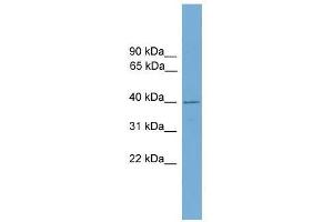 FBXO31 antibody used at 0. (FBXO31 Antikörper  (Middle Region))