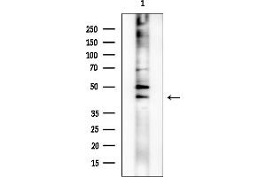 Western blot analysis of lysates from EC304 cells, using DHPS Mouse Monoclonal Antibody at 1/1000 dilution.