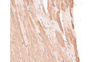 Immunohistochemistry of paraffin-embedded Mouse heart using KIF1C Polyclonal Antibody at dilution of 1:100 (40x lens). (KIF1C Antikörper)
