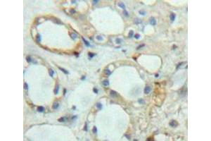 Used in DAB staining on fromalin fixed paraffin-embedded kidney tissue (Ephrin A5 Antikörper  (AA 21-203))