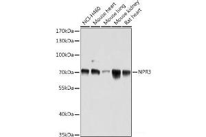 Western blot analysis of extracts of various cell lines using NPR3 Polyclonal Antibody at dilution of 1:1000. (NPR3 Antikörper)