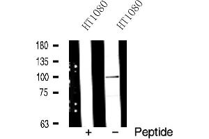Western blot analysis of ADAM 17 expression in HT1080 whole cell lysates. (ADAM17 Antikörper  (C-Term))