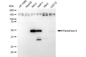 Western blotting analysis using Paired box 6 antibody (ABIN7799725). (Rekombinanter PAX6 Antikörper)