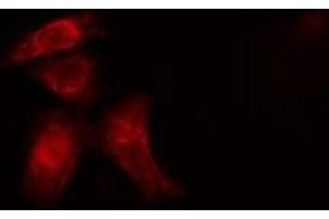 Immunofluorescence (fixed cells) (IF/ICC) image for anti-Internexin Neuronal Intermediate Filament Protein, alpha (INA) (Internal Region) antibody (ABIN6266296)