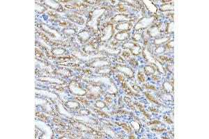 Immunohistochemistry of paraffin-embedded mouse kidney using Syntaxin 16 Rabbit mAb (ABIN7270681) at dilution of 1:50 (40x lens). (Syntaxin 16 Antikörper)