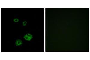 Immunofluorescence analysis of A549 cells, using NPY2R antibody. (NPY2R Antikörper  (N-Term))